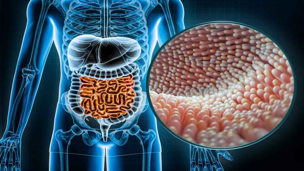 mikrobioma usus dan kesehatan mental