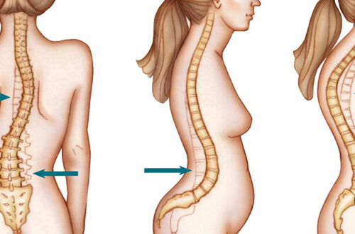kesehatan tulang pada wanita